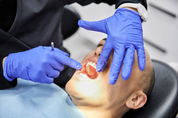 Best Emergency Wisdom Teeth Removal in East Falmouth, MA